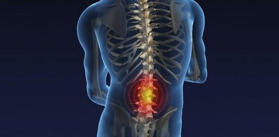Back pain with osteochondrose of lumbar