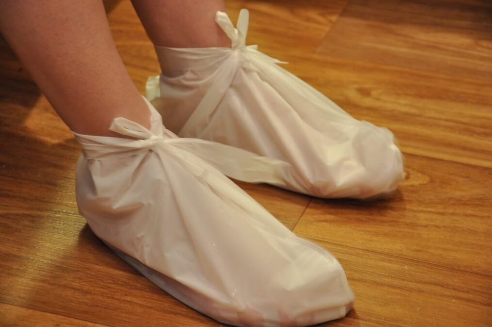 compresses for arthrosis of the ankle joint