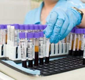 a blood test to diagnose joint pain