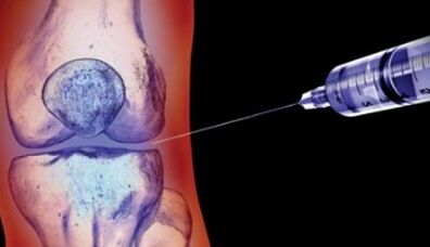 methods of treatment of arthrosis of the joints